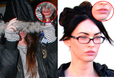 megan fox plastic surgery before and after