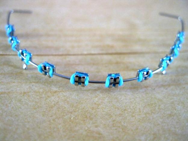 Gambar Behel Lepas Pasang Gambar Behel Lepas Pasang