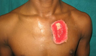burns mobile phone surgeon clinics surgery general