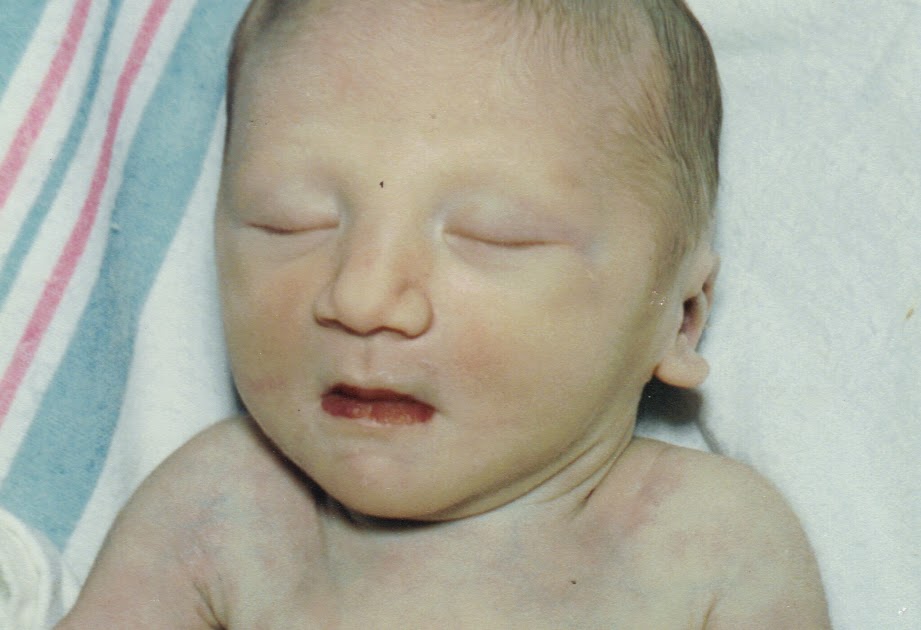 Potter's Syndrome Still feeling his presence...