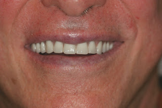 Golpa-DentalImplantCenter.com