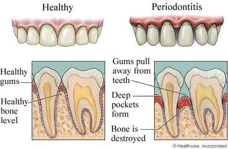 What+healthy+gums+look+like