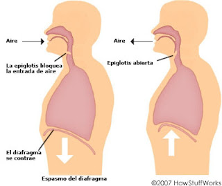 Cuando la epiglotis bloquea la entrada de aire se produce el hipo. Imagen: www.howstuffworks.com, traducción Recicla Inventa.