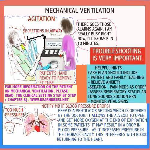 Dear Nurses THE PATIENT ON MECHANICAL VENTILATION