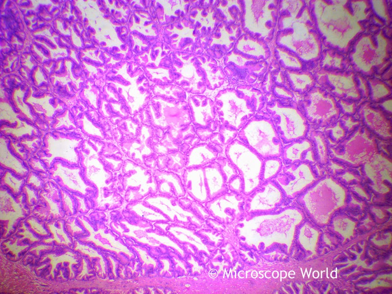 Microscopy image of the prostate gland.