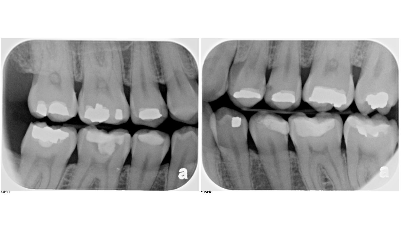 Dental News and Views Initial Dental Exam