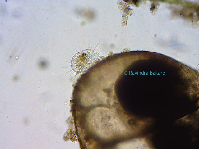 Protozoan Actinosphaerium sp. under the microscope at 10x.