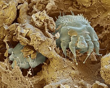 Itch Mite