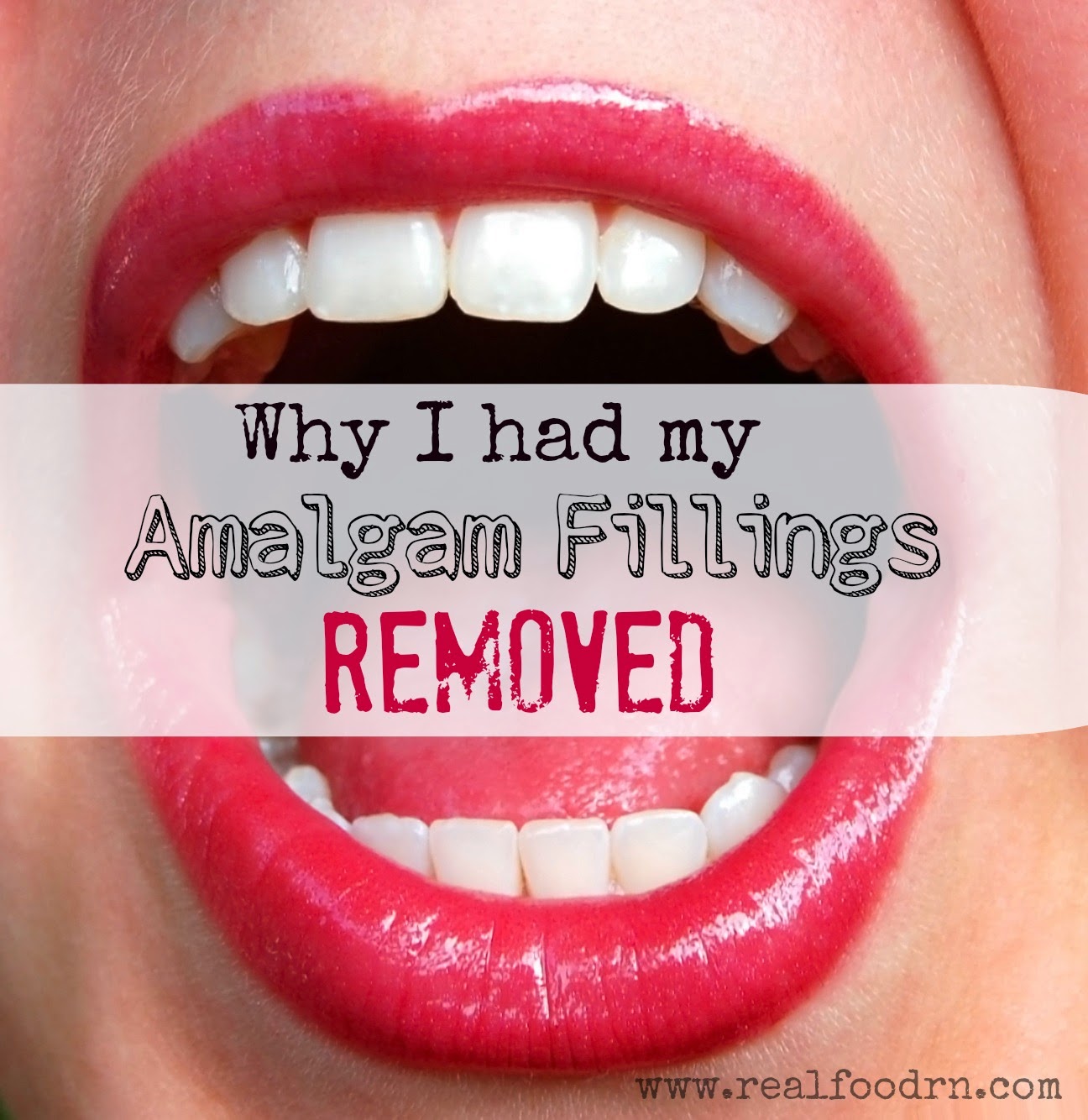 Divinely Toxic Mycotoxins, Toxic Mold, Toxins, Candida and You