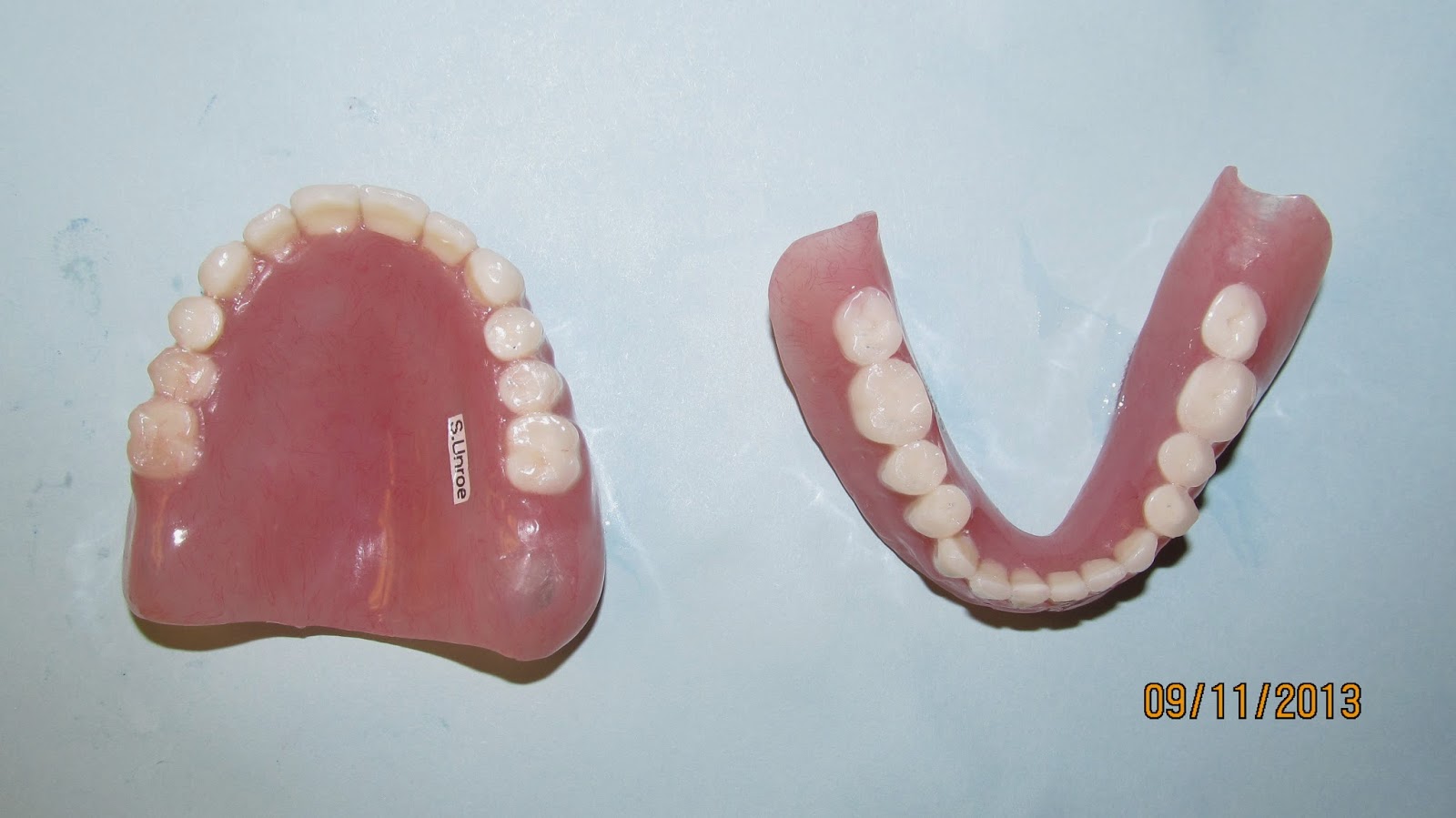 Dental Clinical Case Presentations StepbyStep guides Complete Denture Fabrication