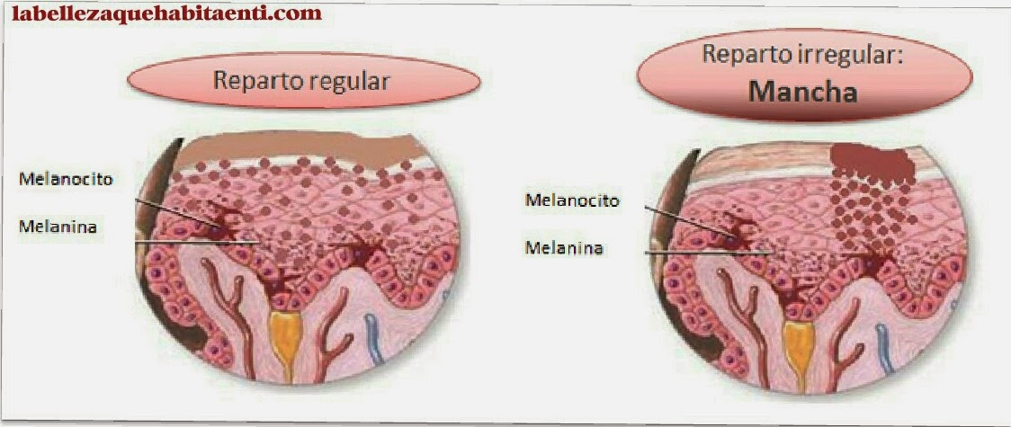 Blanquear los labios de las manchas de pigmento
