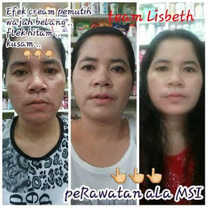 Testimoni Biospray