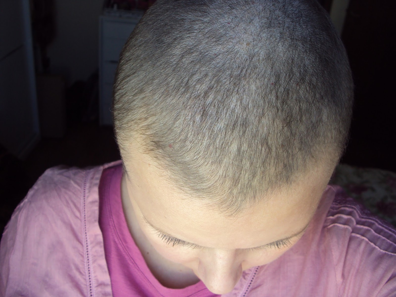 Viver um dia a cada dia....: Acompanhamento de crescimento do cabelo