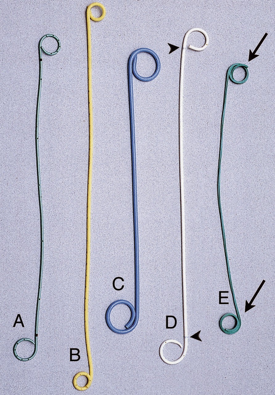 Brady Urology at Johns Hopkins Hospital Ureteral Stents Necessarily a