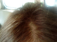 hair loss treatment with tamarind