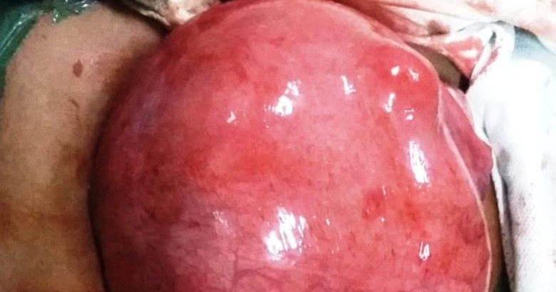 journal of postgraduate gynecology obstetrics successful