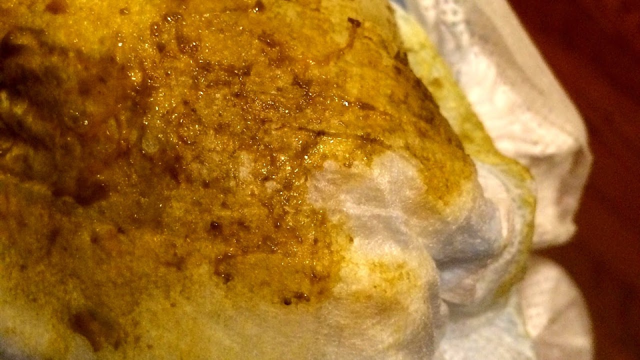 0 Result Images of Green Strings In Breastfed Baby Poop PNG Image