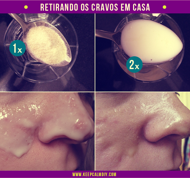 O pigmentary nota em uma doença de fígado