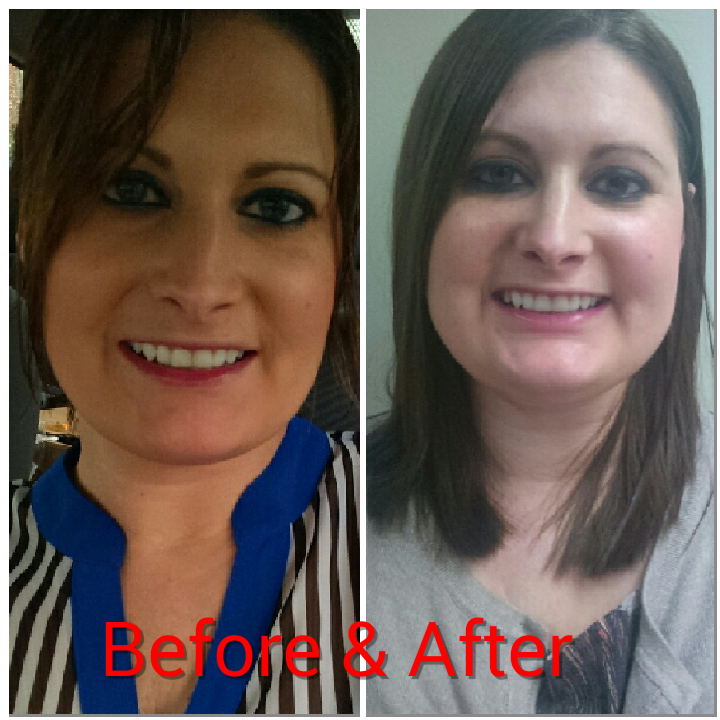 On a Baby Quest Pregnancy+Prednisone= Puffyface