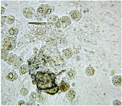 Metodos de Laboratorio para el Diagnostico Clinico