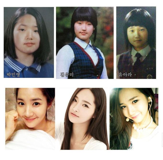 Miss Korea 2013 Yumi Kim Before Plastic Surgery