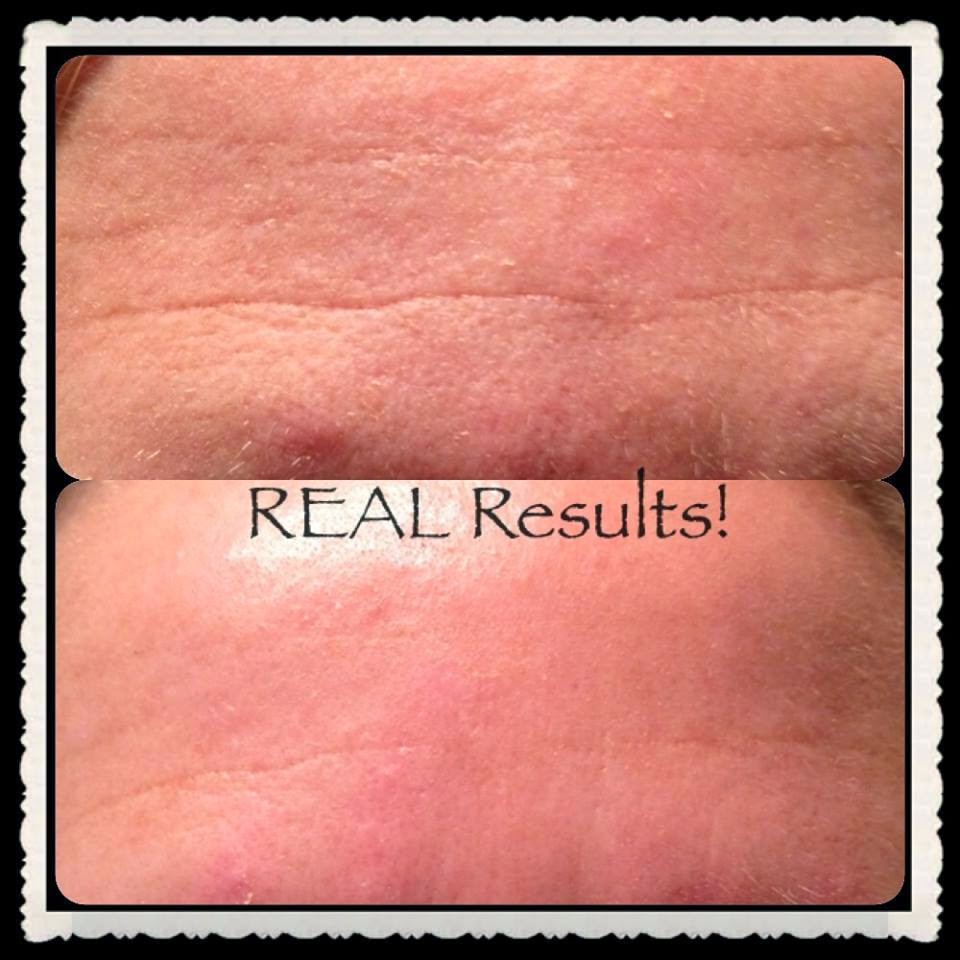 My REAL Nerium Results!