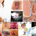Apa Ada Ambeclear Obat Ambeien Di Apotik thumbnail