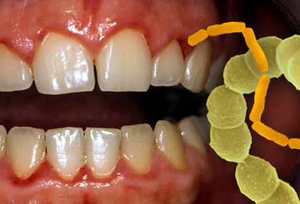 What+should+healthy+gums+look+like