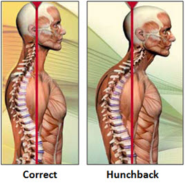 The Back Dr's Blog- Better Posture, Better Sleep & Pain Relief: Why