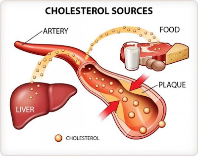lowering cholesterol quickly
