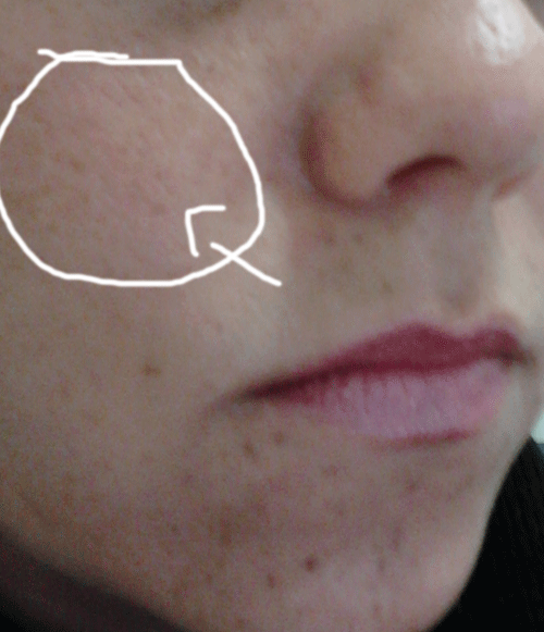 Meios de lugares pigmentary de Chanel