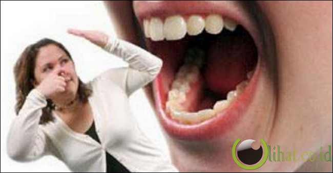 5 Cara mencegah Bau Mulut saat Berpuasa