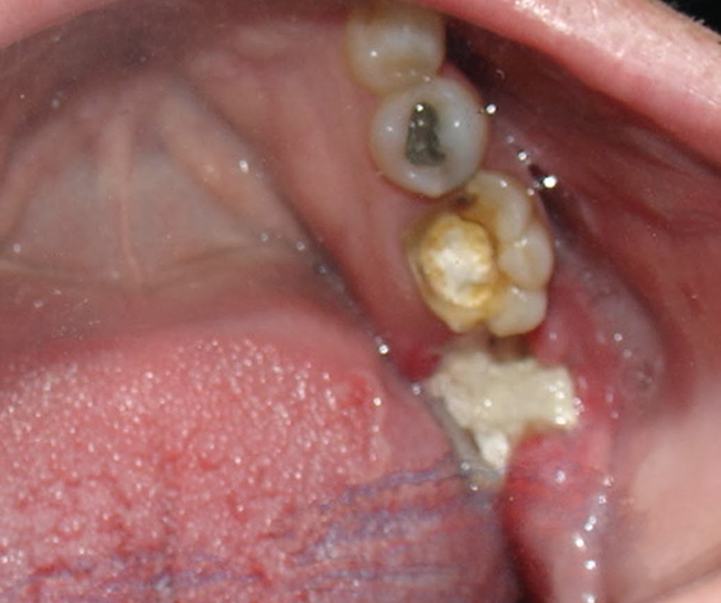 La foto clínica muestra hacia