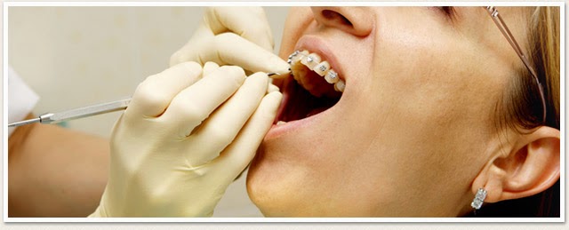 Dental implants in Gurgaon
