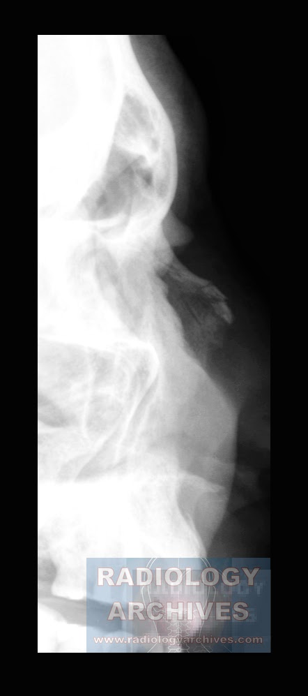 Radiology Archives: Ιουνίου 2013