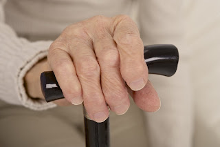 La artritis degenerativa