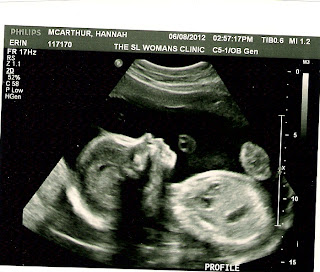 Kyleur & Hannah Forever