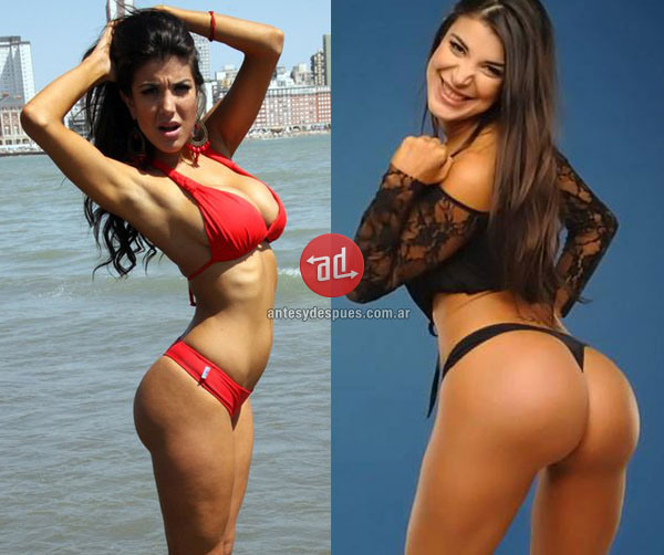 10 celebridades que aumentaram o bumbum 10 celebridades que aumentaram o bumbum
