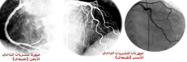 نقره لتكبير أو تصغير الصورة ونقرتين لعرض الصورة في صفحة مستقلة بحجمها الطبيعي