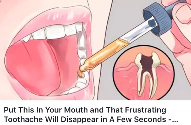 How To Get Rid Of A Toothache In 3 Seconds | Avoid A Dentist