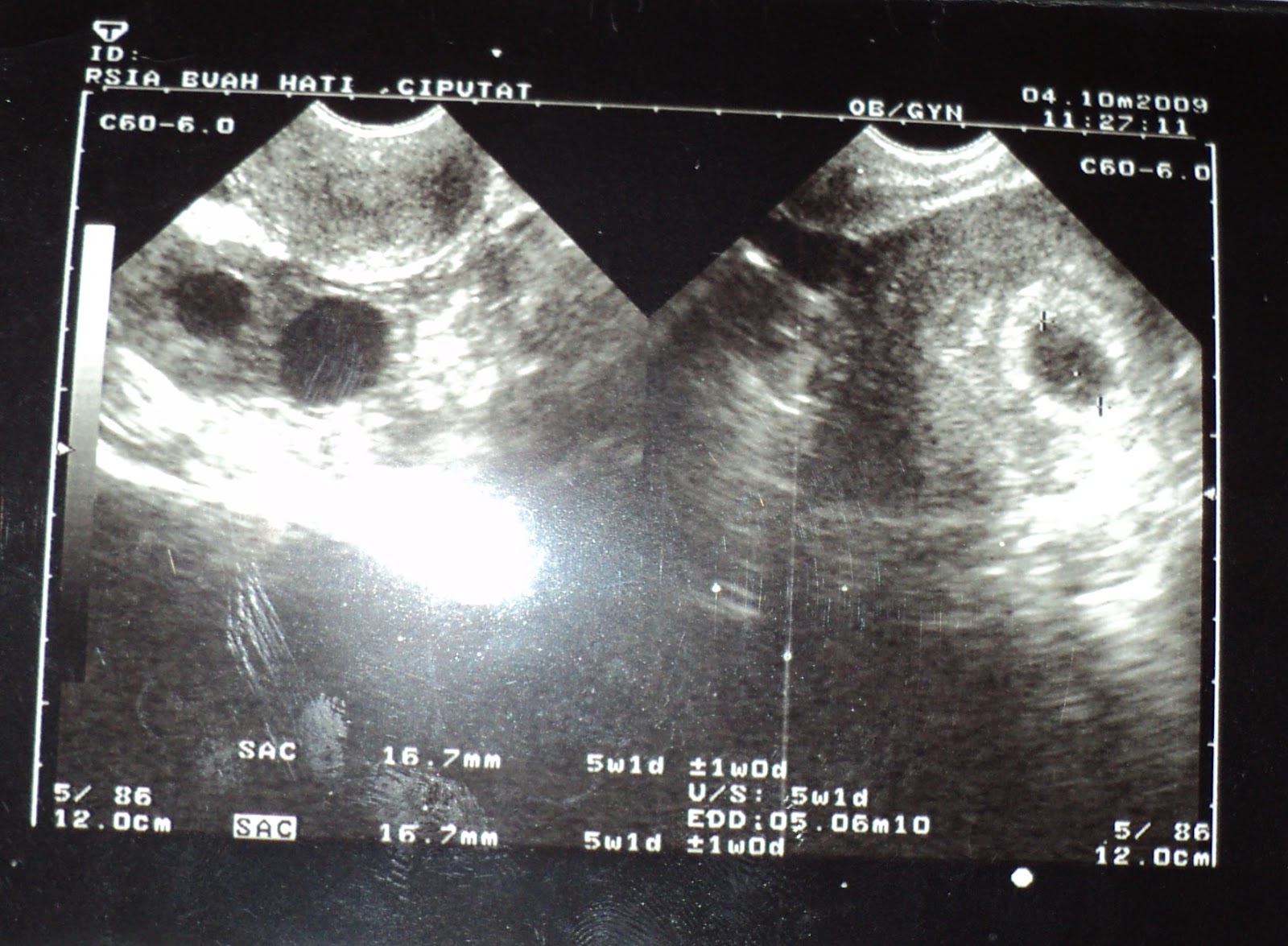 URBAN KOTA: Beburu Berkah Lewat Air Manaqib; Dari Atasi Penyakit