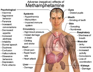 Amphetamine Withdrawal