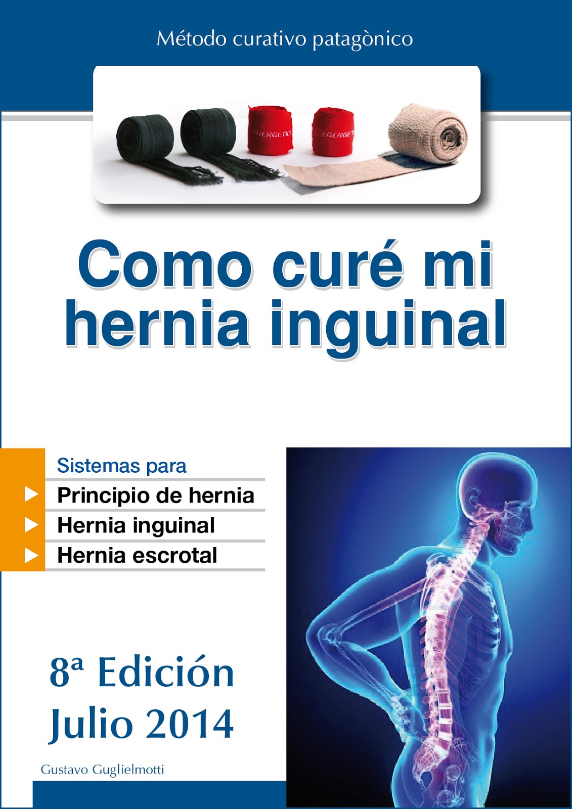 Hernia inguinal