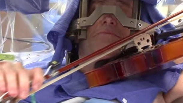 Violinista toca durante cirurgia ao cérebro (com video)