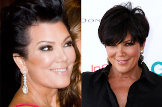Garth Fisher Plastic Surgery on Chatter Busy  Kris Jenner Plastic Surgery