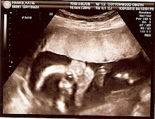 Baby Boy                   Due February 24th, 2013