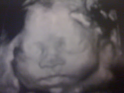 Our son 10/4/10