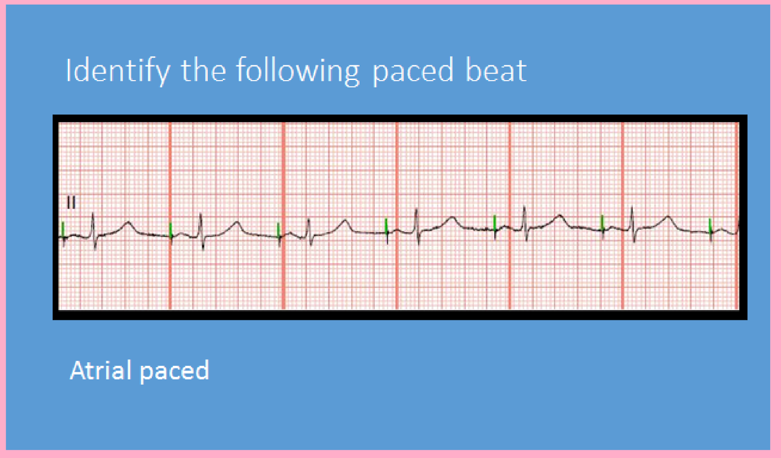 Telemetry Technician Course: Pacemaker Practice (class 10)