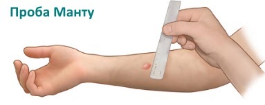 Проба Мастурбатора