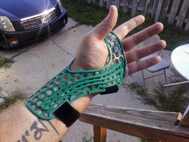 3d Printable Diy Hand Wrist Brace Article Tue 05 Aug 2014 01